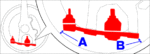 Super-Multi_Camber_Adaptor_HyperCamber